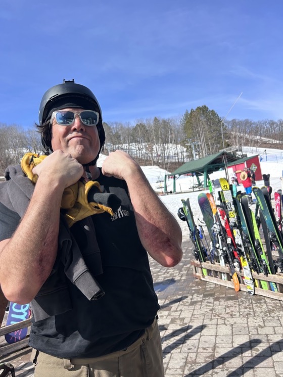 David in a t-shirt and helmet at Wild Mountain on a warm spring day, ski racks and a chairlift behind him.